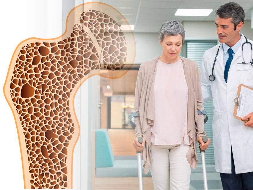 Qué es la osteoporosis: síntomas, causas, diagnóstico y tratamiento.