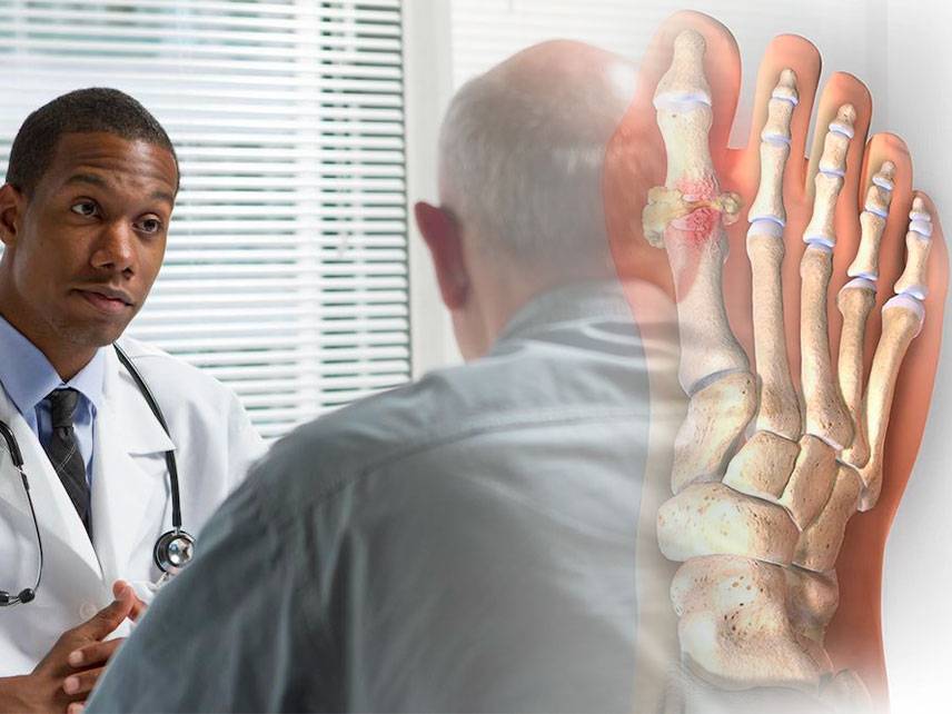 What is Gout: symptoms, causes, diagnosis, treatment.